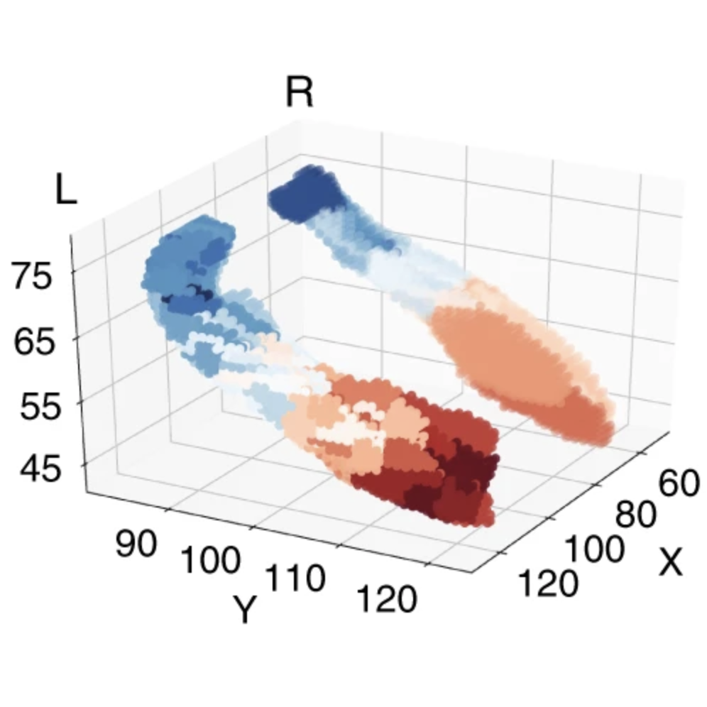 Neuroimaging and gene expression